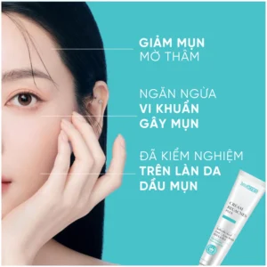 Top 5 Kem Trị Mụn Hiệu Quả Cho Da Mụn Nổi Tiếng Trên Thị Trường Hiện Nay
